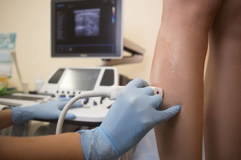 Ultrasound diagnosis of varicose veins